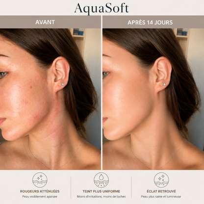 Pommeau filtrant Vitamine C et Acide Hyaluronique AquaSoft®